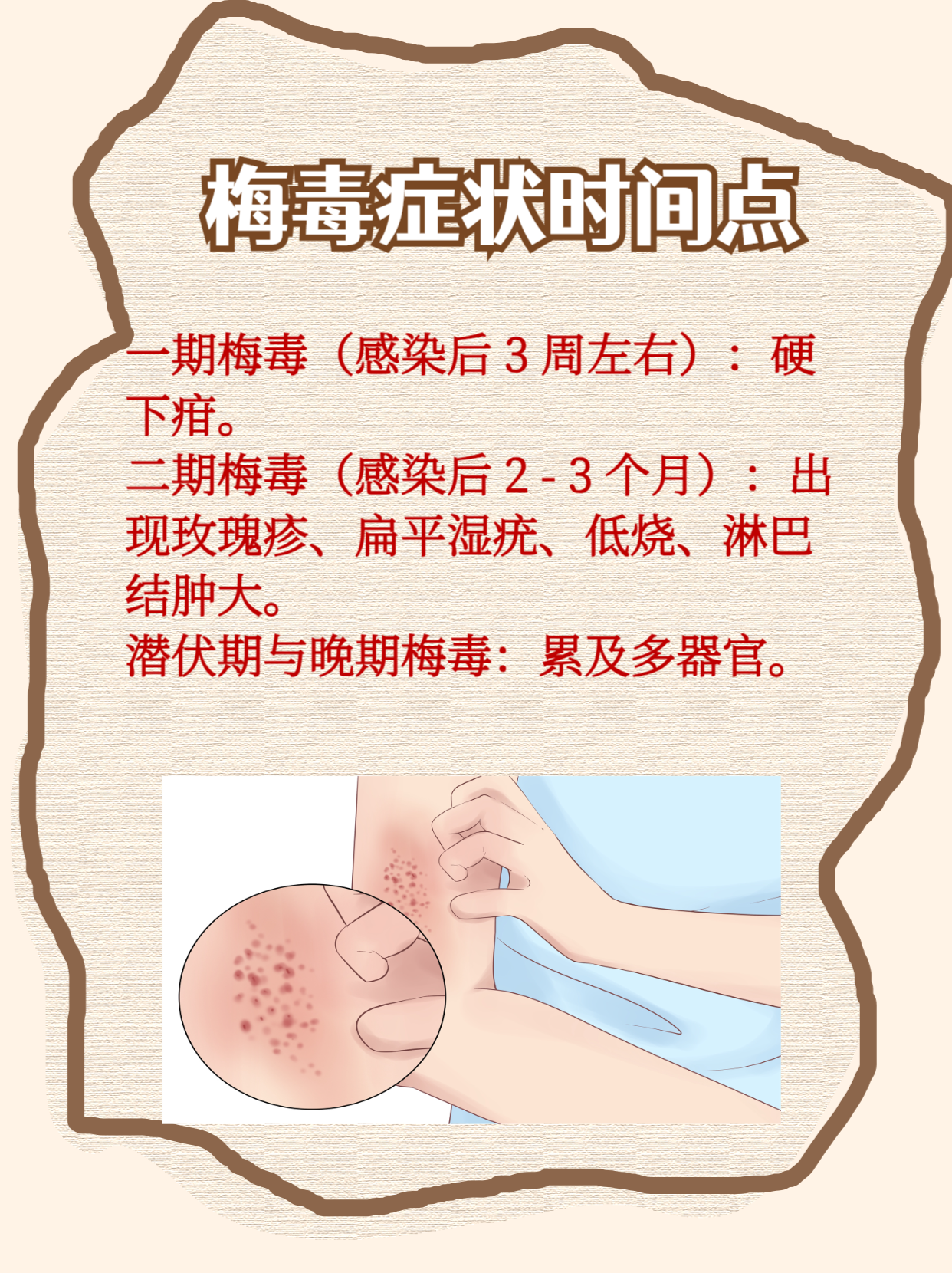 为什么会有梅毒携带者为什么在线