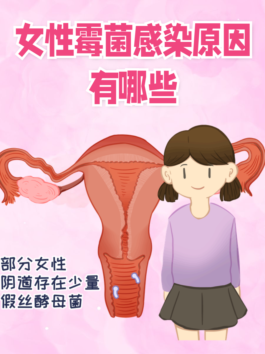 可能是这几个原因  霉菌感染是女性常见的妇科问题之一