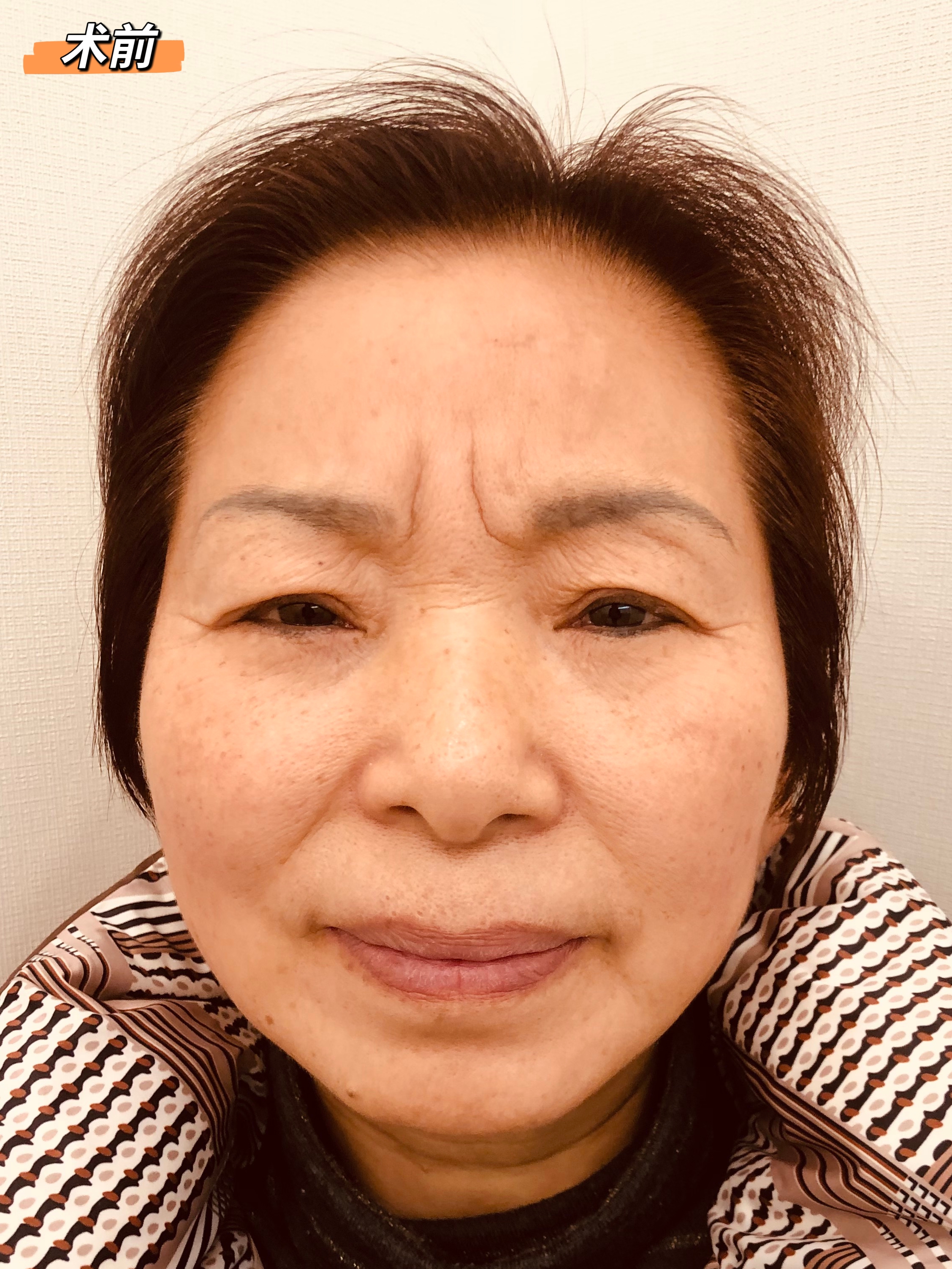 面部抗衰医生任冲