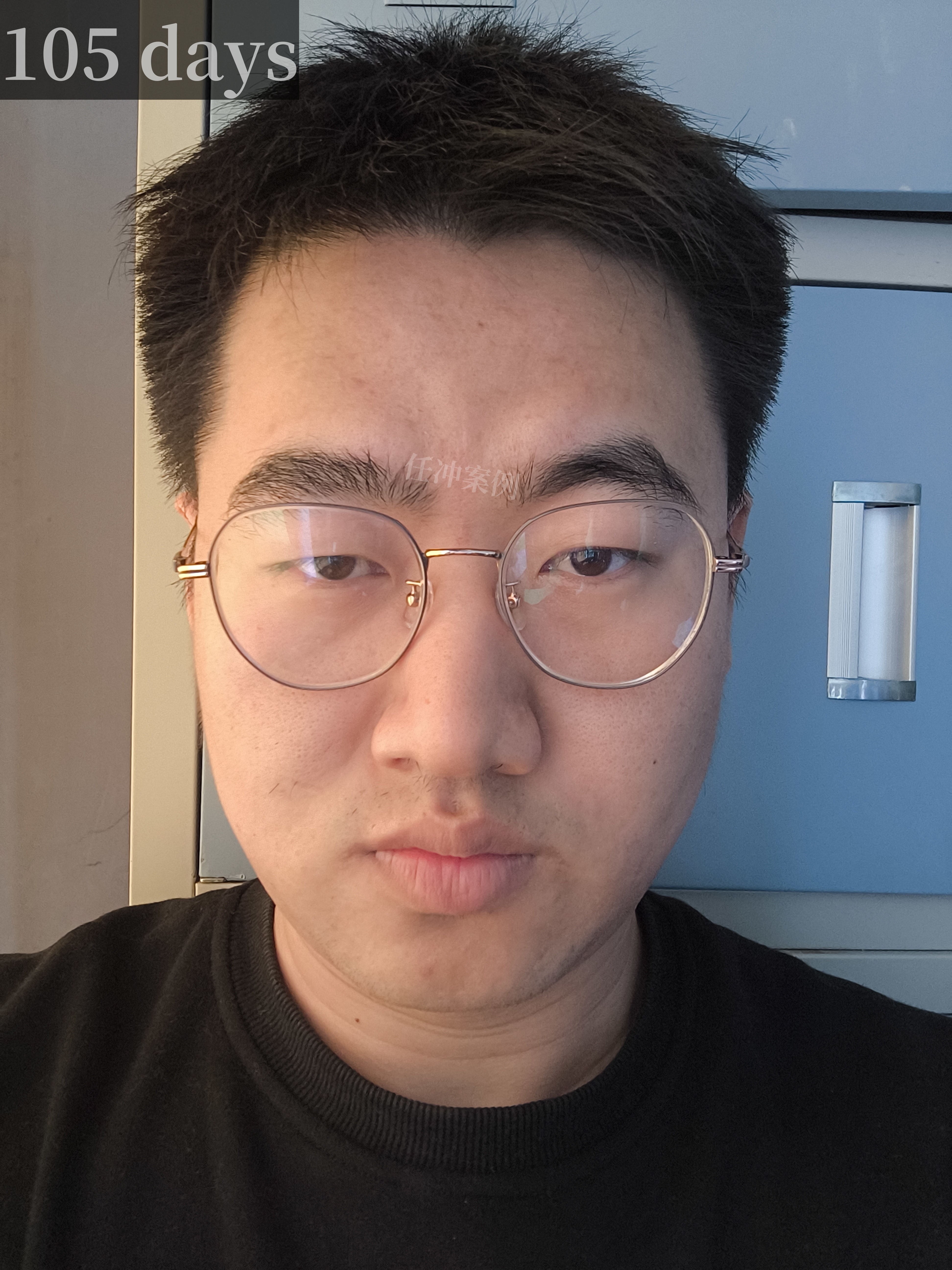 男人有川字纹预示着什么?