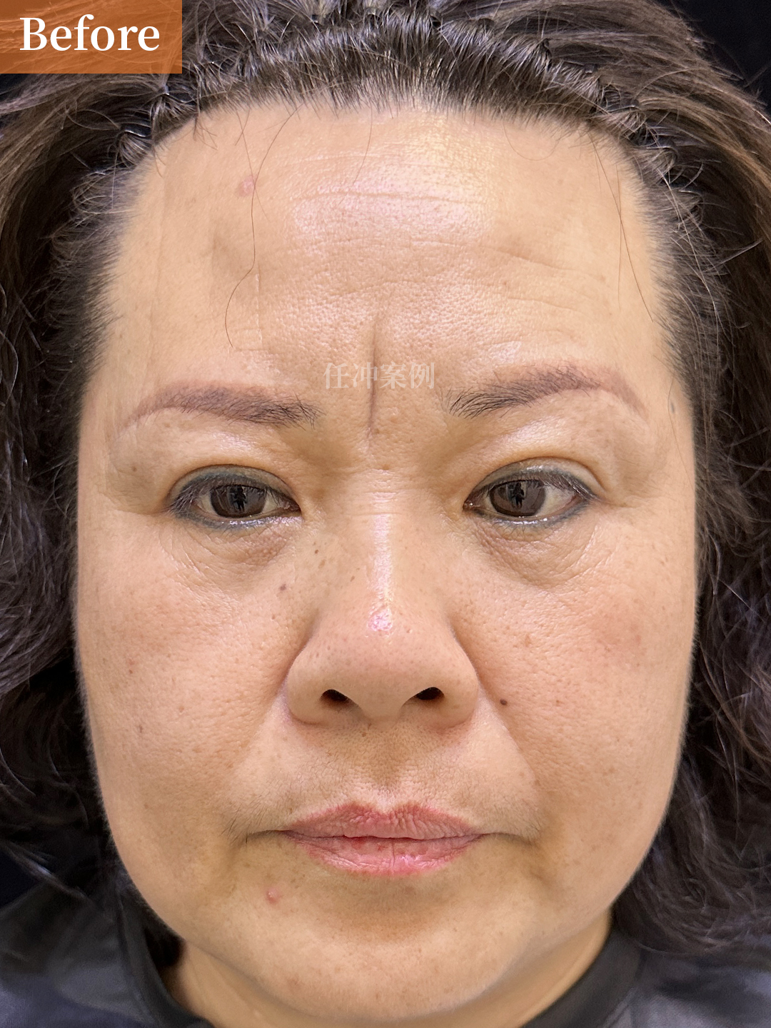 这道顽固的纹路,像无形的隔阂,悄然疏远了她与孩子间的亲密距离