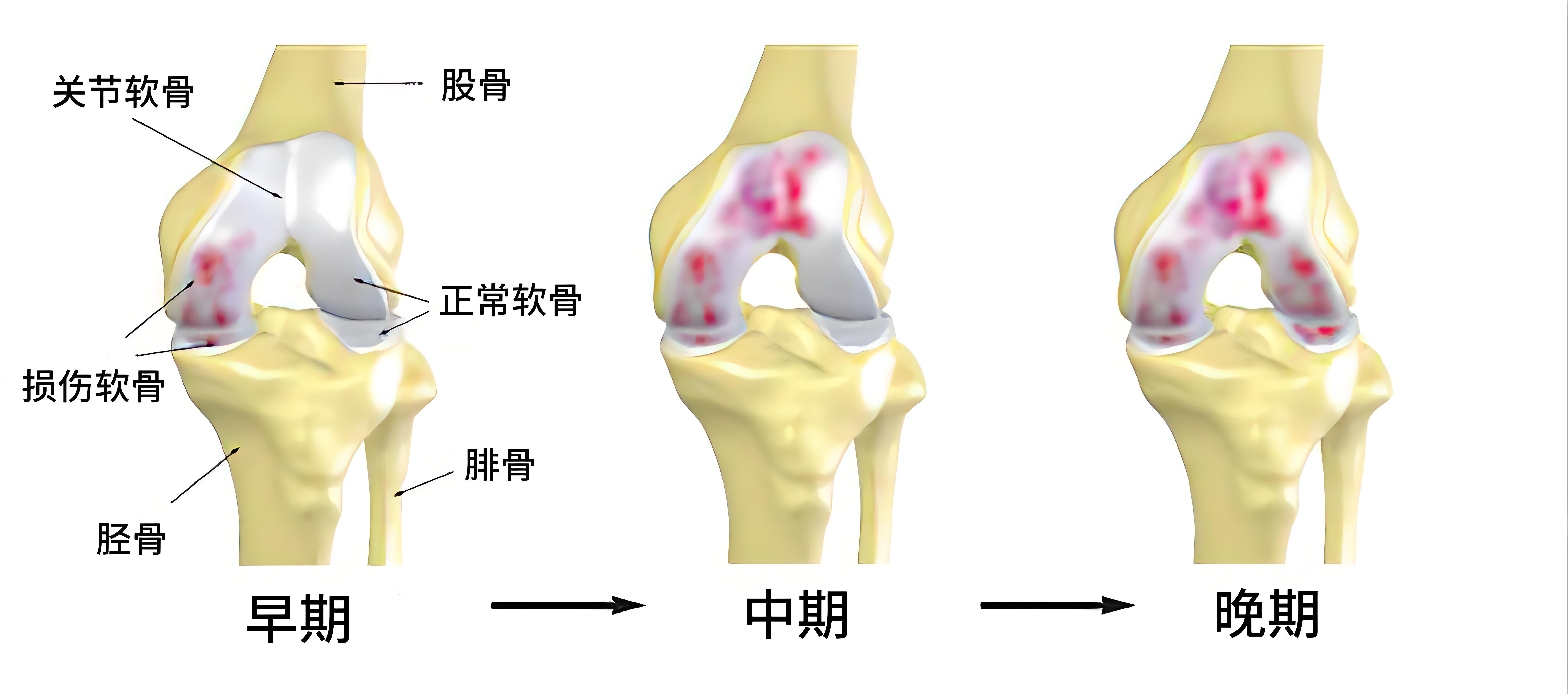 膝关节位置图图片