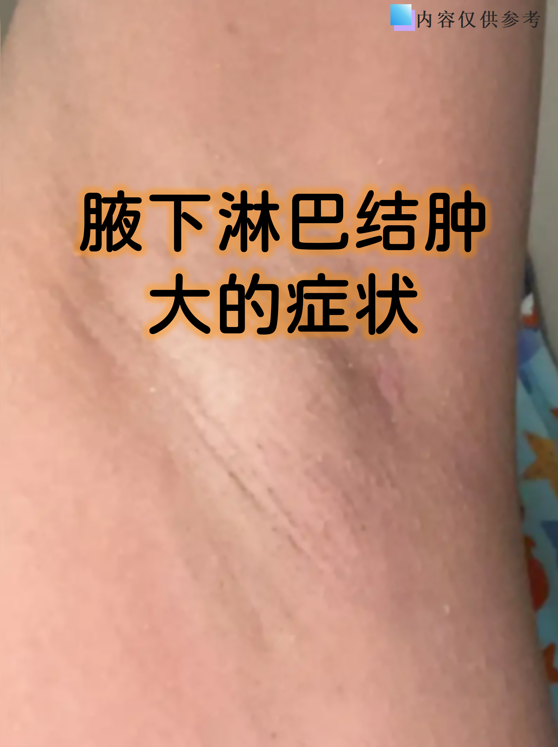 腋下淋巴结肿大的症状