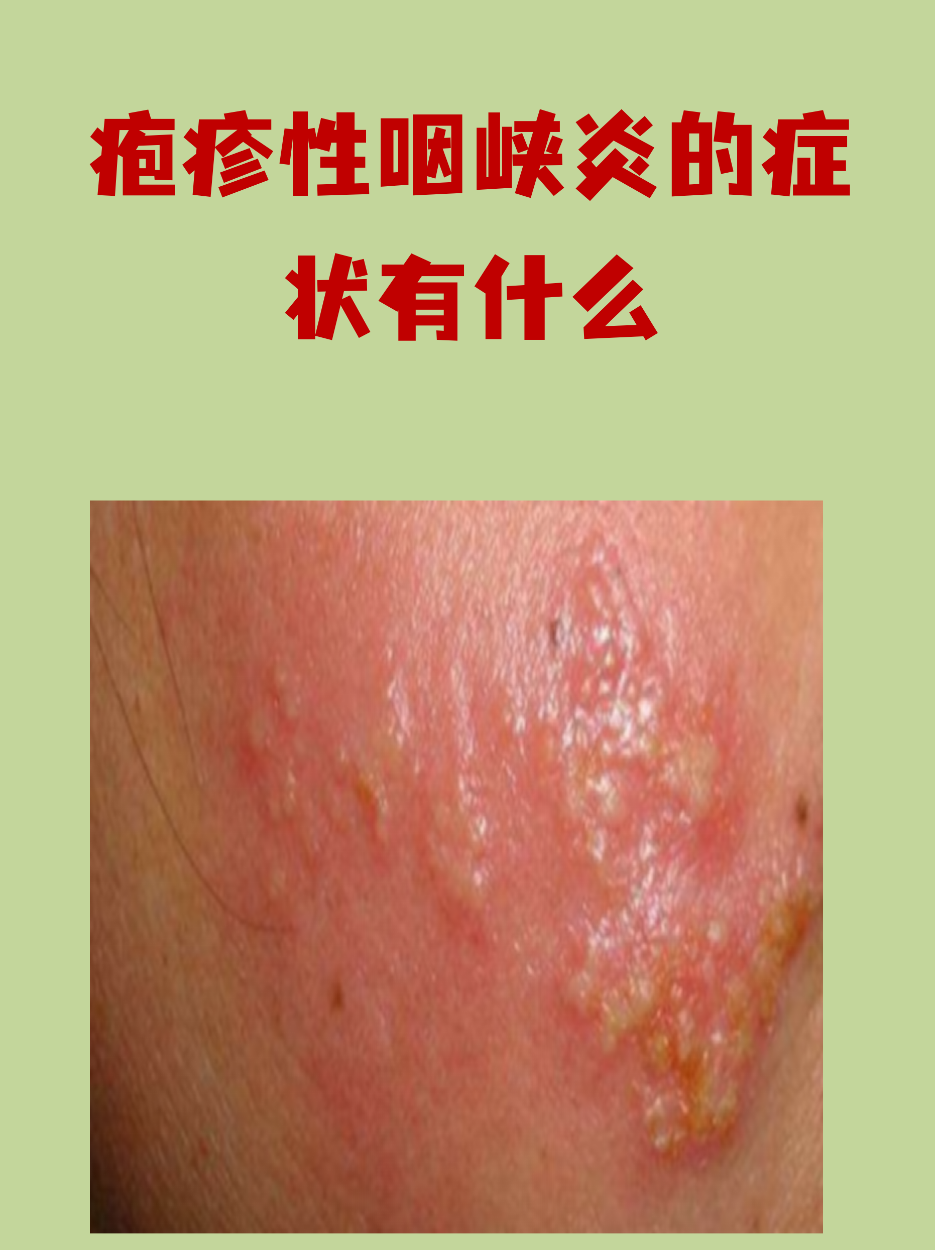  最近病毒有什么症状吗会传染吗(最近出现的病毒是什么病毒)