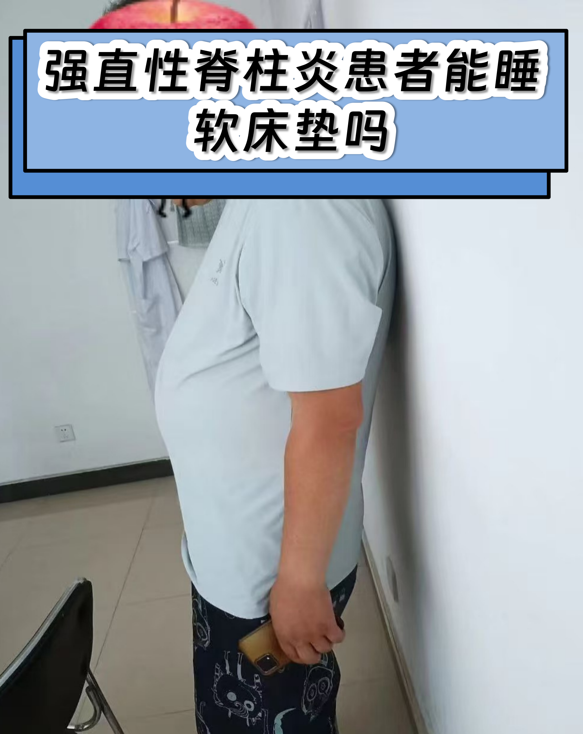 强直性脊柱炎患者能睡软床垫吗