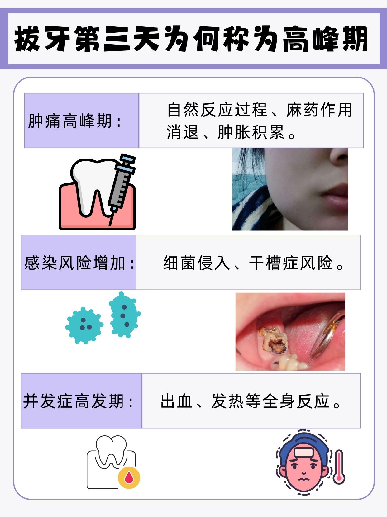 为什么下午不拔牙