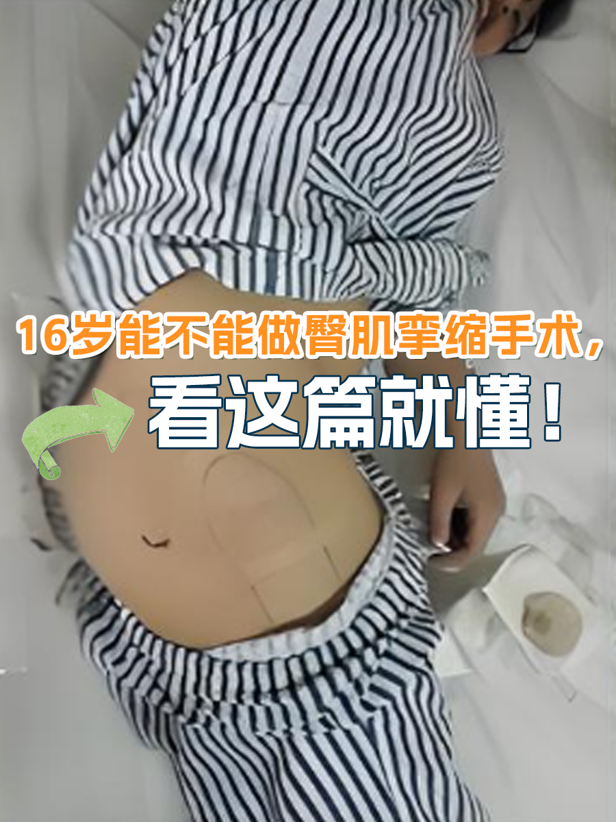 臀肌挛缩症是一种影响臀部肌肉的疾病,它会导致肌肉纤维变性,挛缩