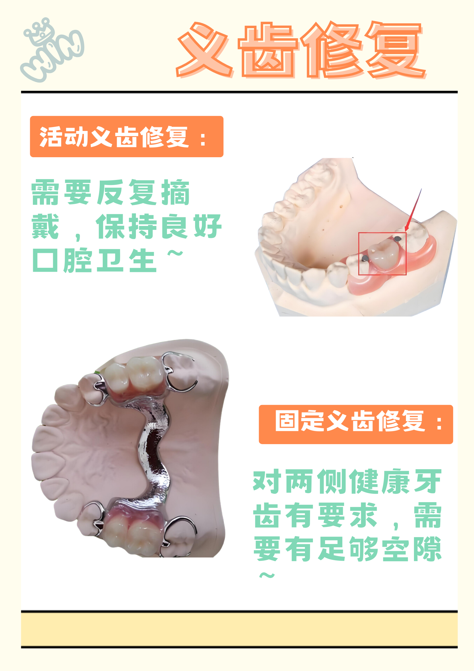 缺了一颗大牙又不想种植怎么办 缺了一颗大牙但又不