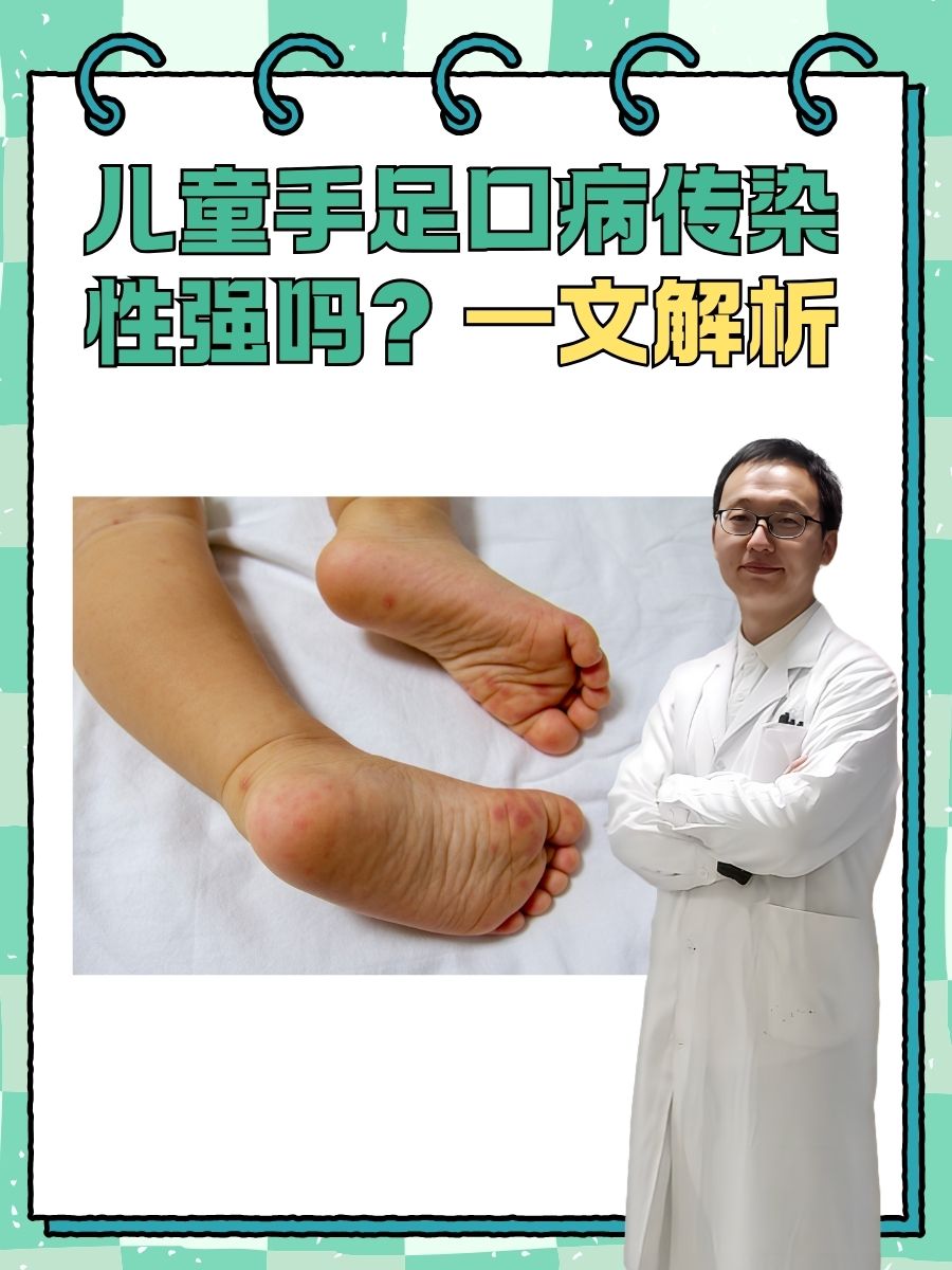一文解析  很多家长,对手足口病总是格外关注