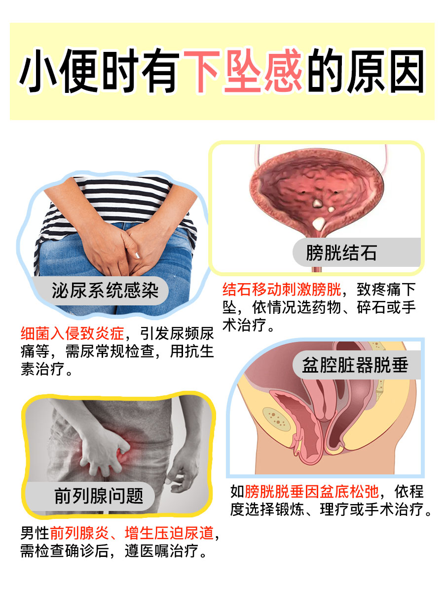 尿的时候下腹坠胀感(尿的时候下腹坠胀感怎么办)