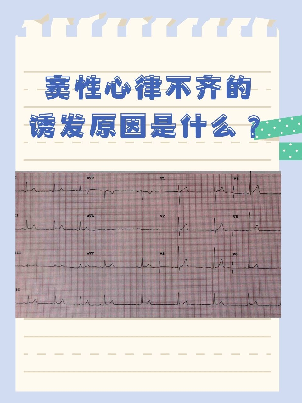 心律不齐的症状图片