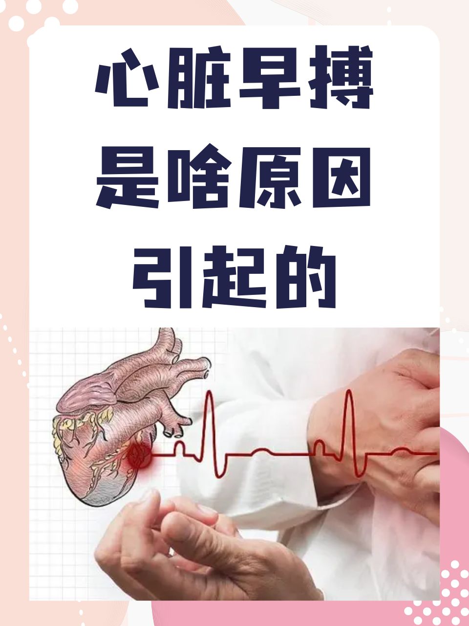 心脏早搏是什么原因引起的  早搏作为一种常见的心律失常现象,指的是