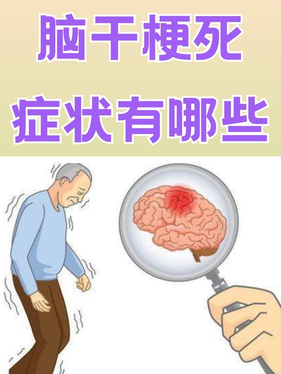 脑干梗死图片