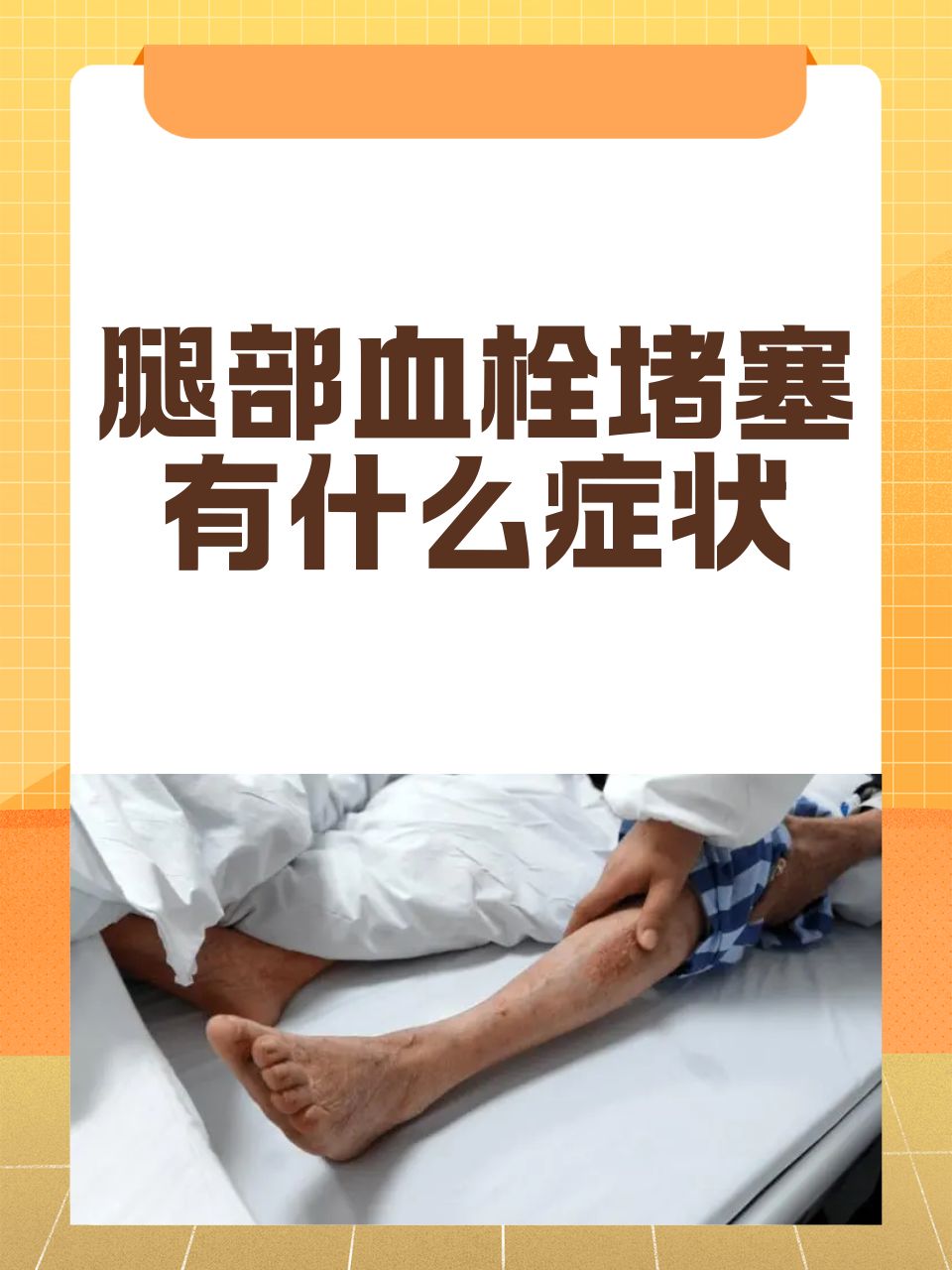 腿部血栓堵塞有什么症状