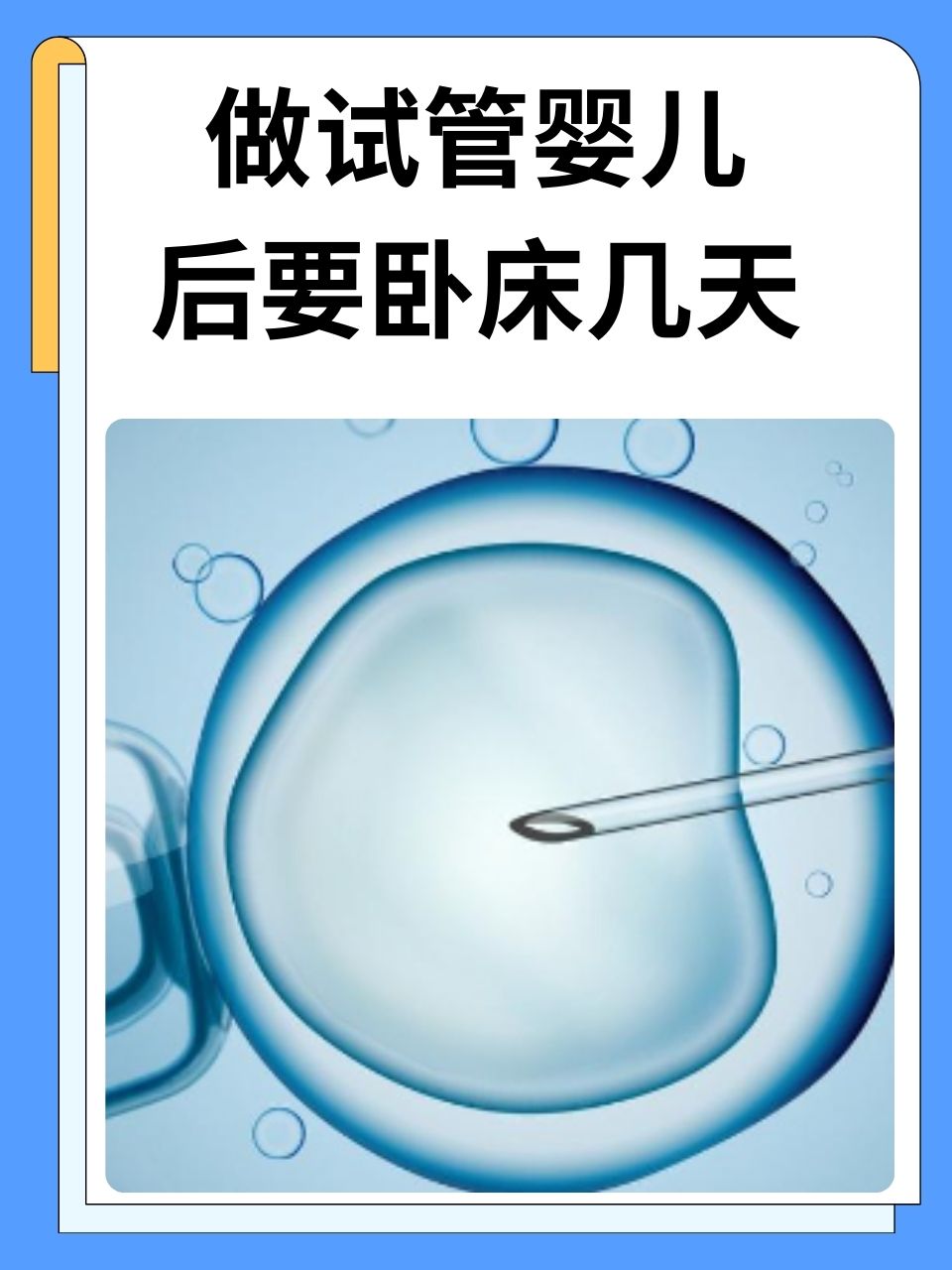 试管如何胚胎移植(试管如何胚胎移植成功)
