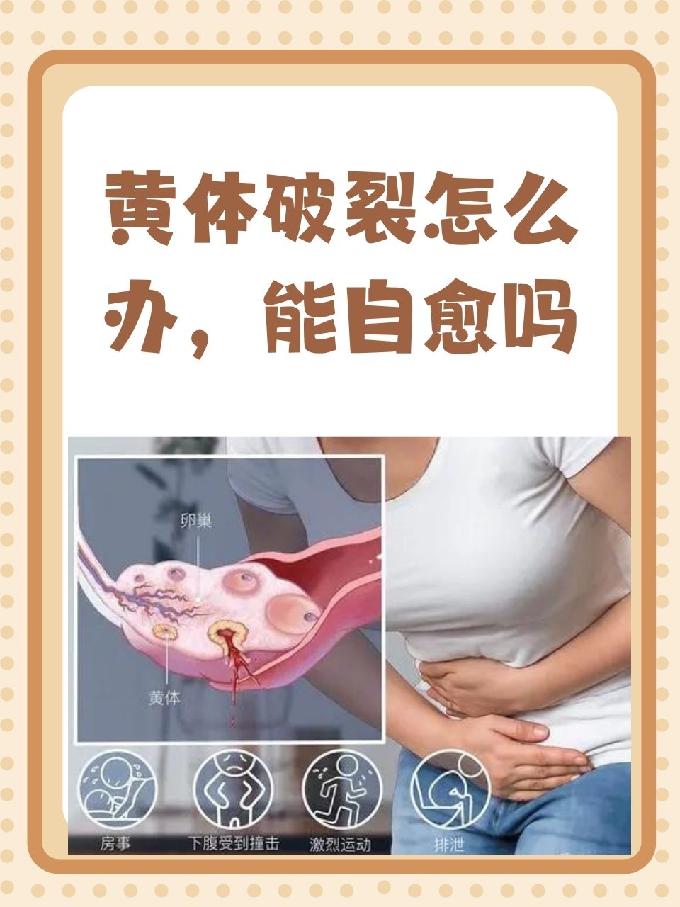 黄体破裂怎么办,能自愈吗