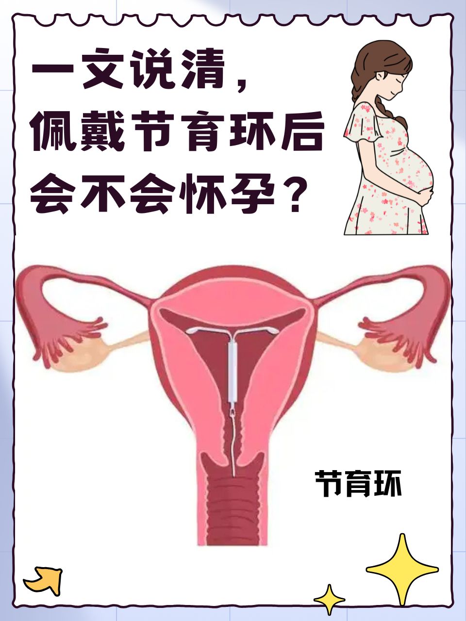  节育环节育环原理避孕环节育环工作原理图爱母环作用原理避孕环安装