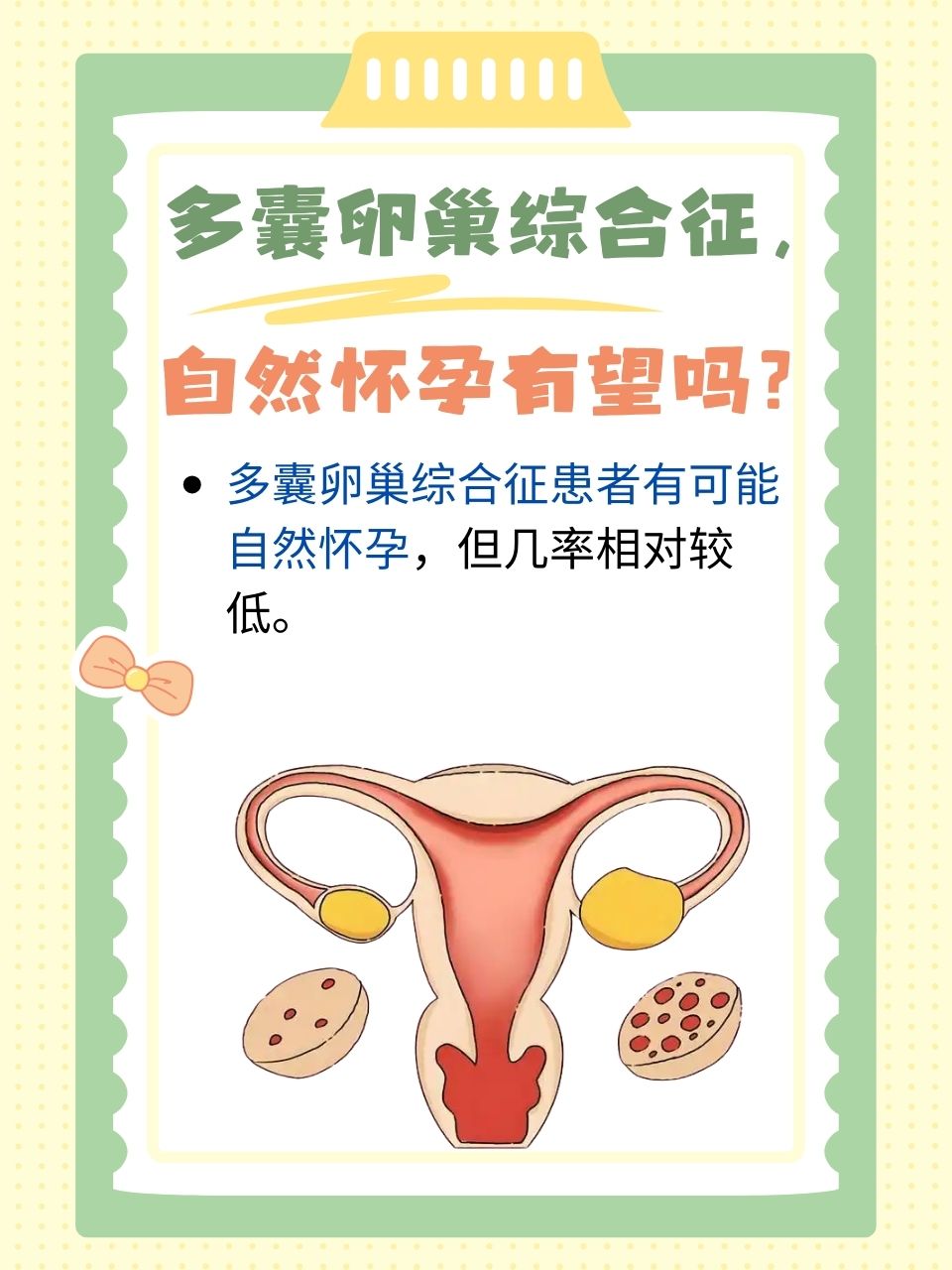 导致卵巢多囊_多囊卵巢会引起什么病变?  第2张