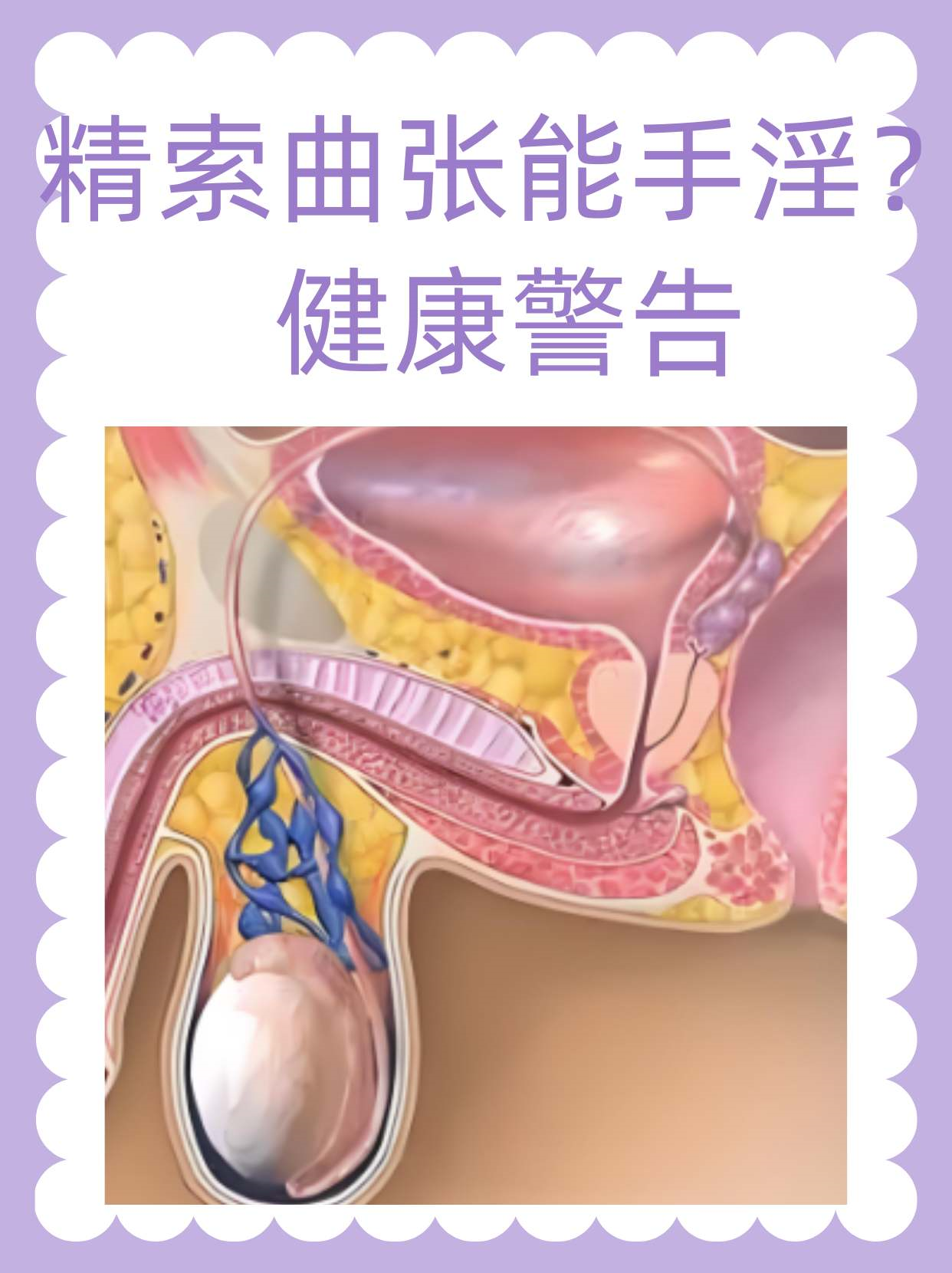 健康警告 在男性健康领域,精索静脉曲张是一个较为常见的问题,可能