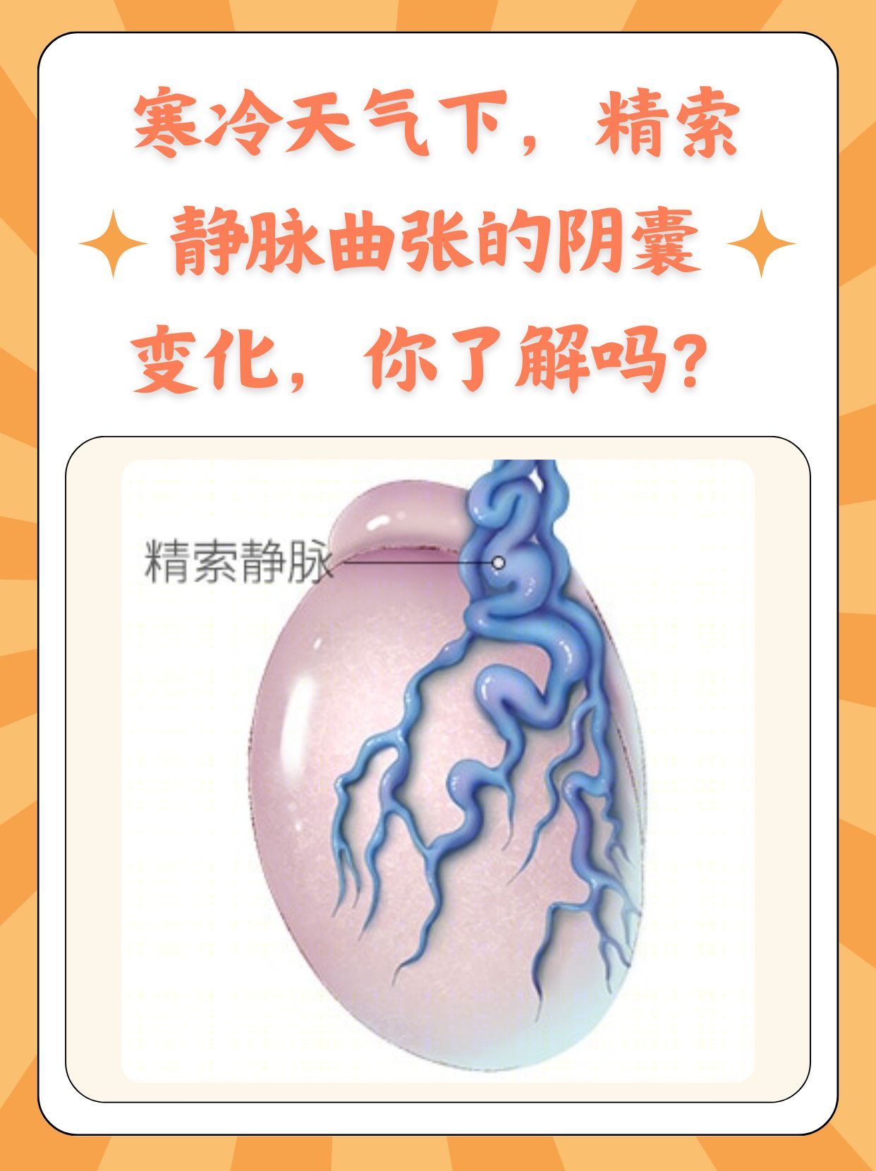 在寒冷的天气里,精索静脉曲张患者的阴囊会变得更大,更饱满吗?