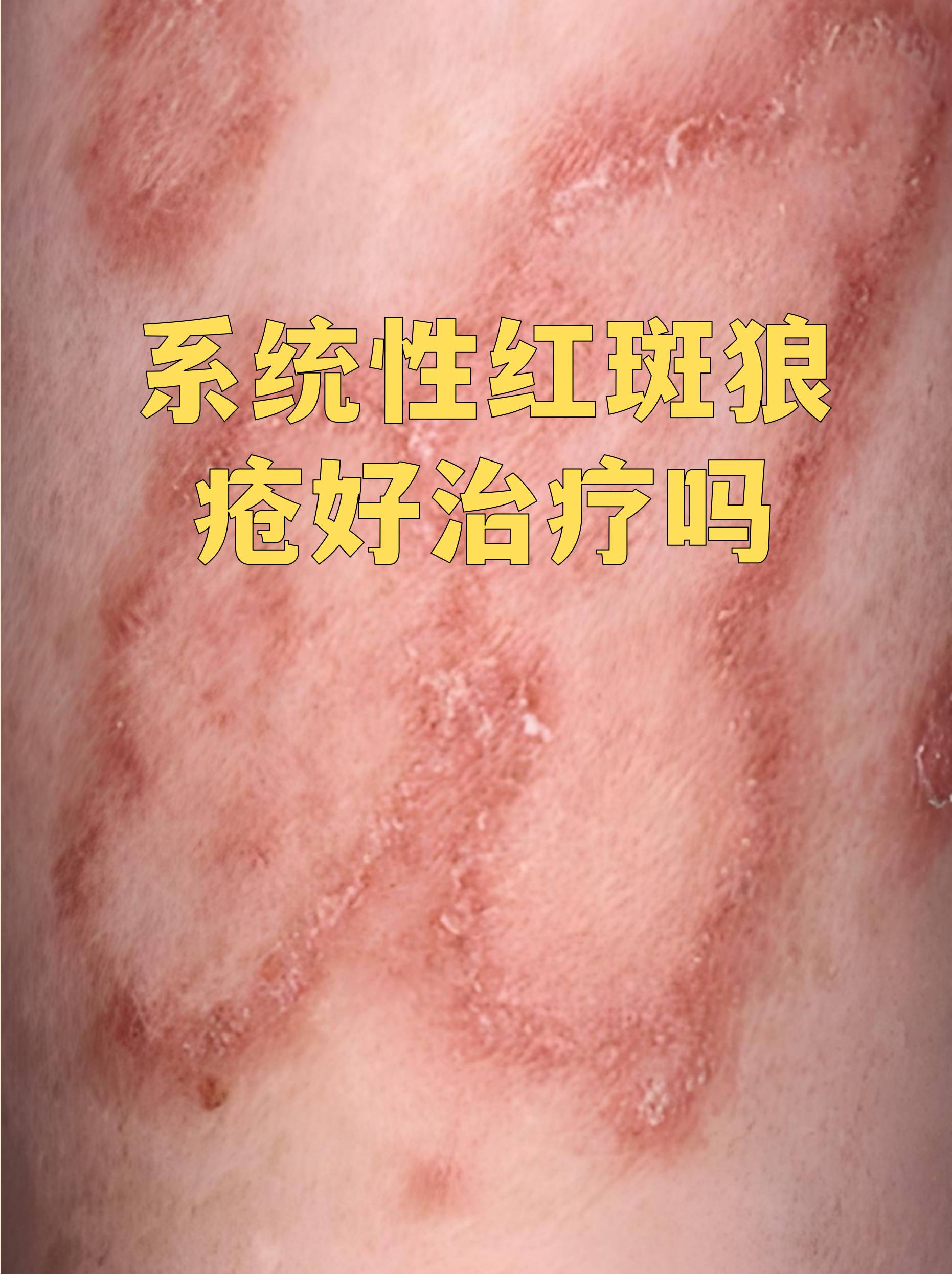 地坛医院代取报告代挂号复杂病情综合分析,治疗方向更明确的简单介绍 地坛医院代取报告代挂号复杂病情综合分析,治疗方向更明确的简单介绍