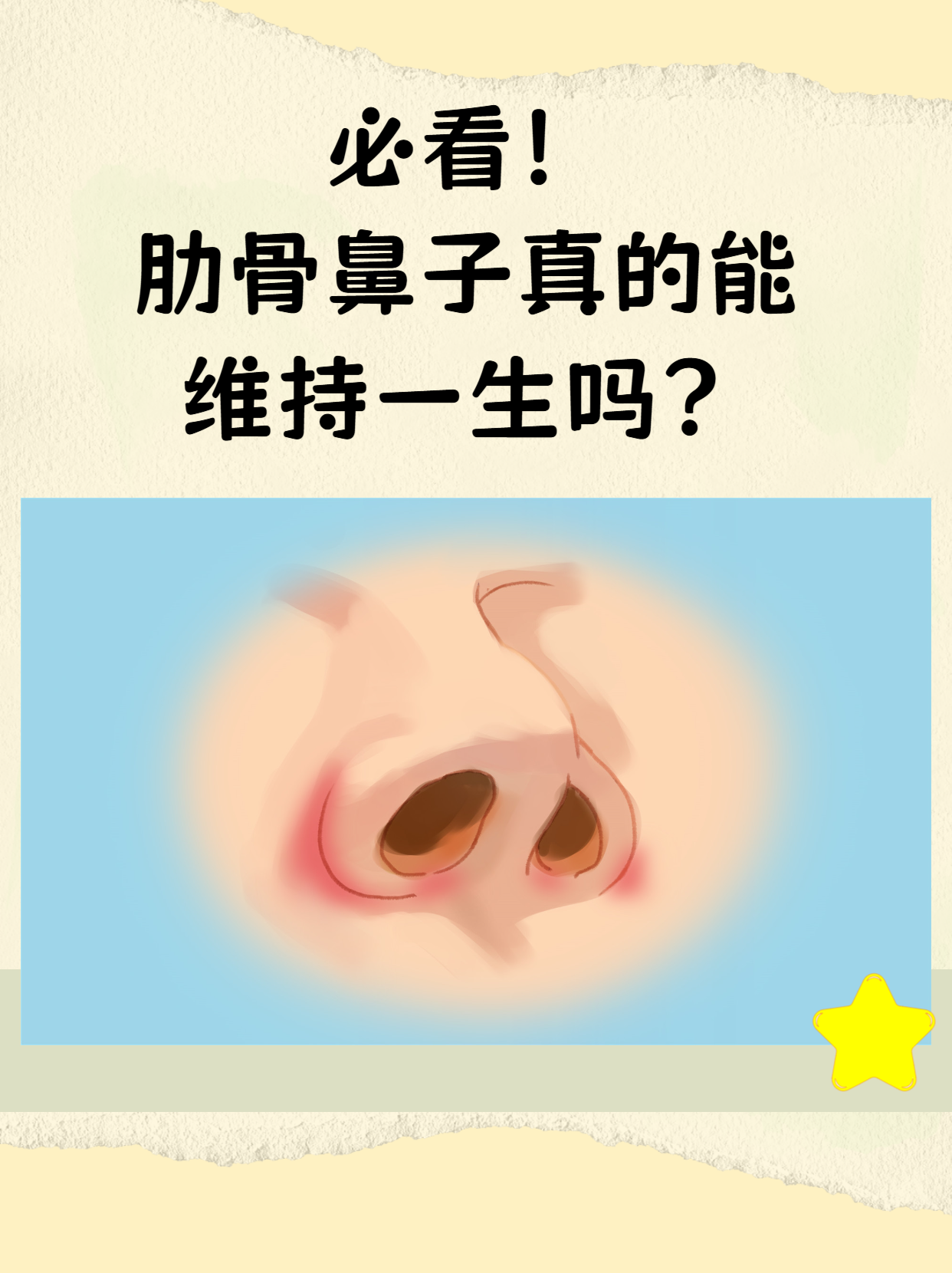 肋骨鼻子真的能维持一生吗?