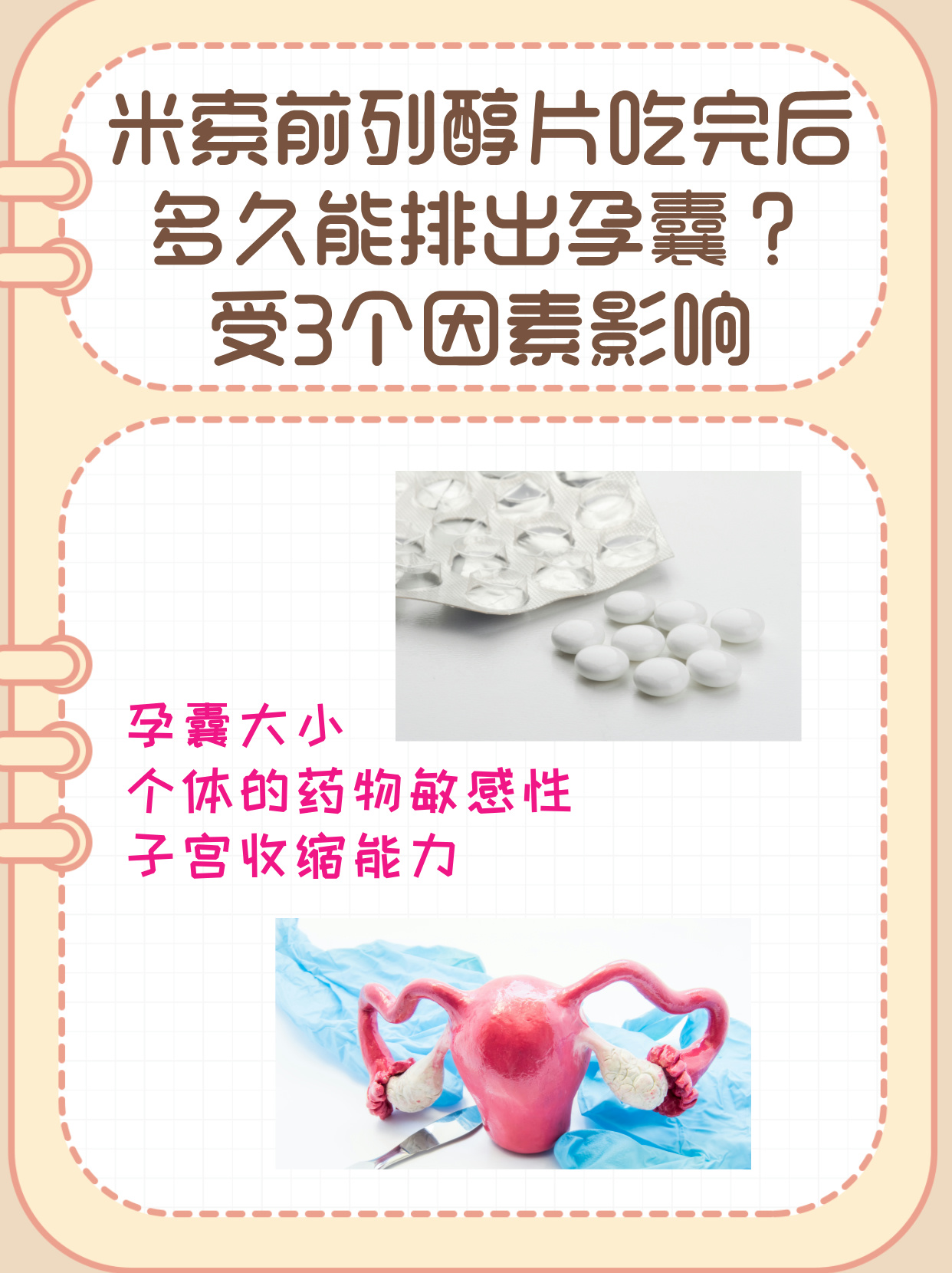 🚃2025年米索前列醇片说明书保质期(最新分享米索前列醇片样子信息)
