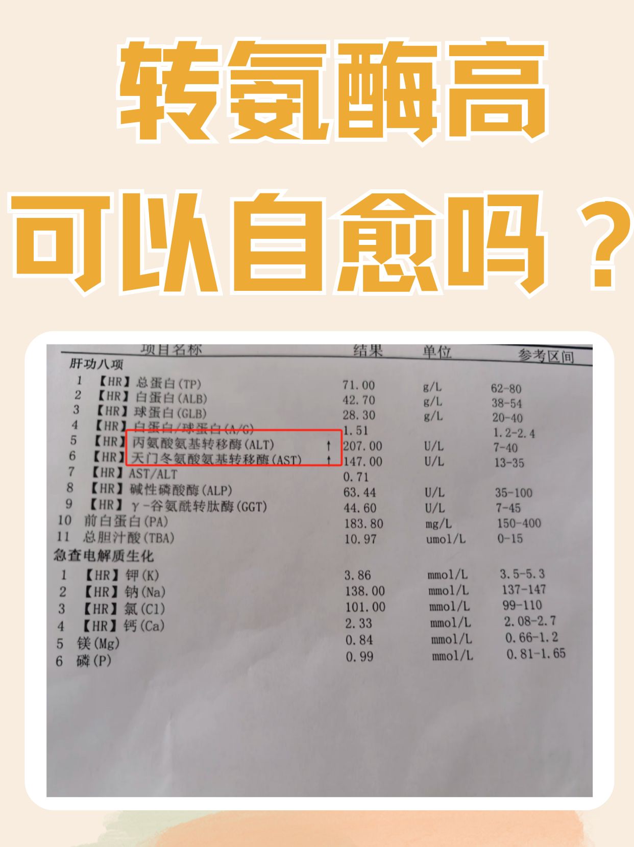 转氨酶偏高