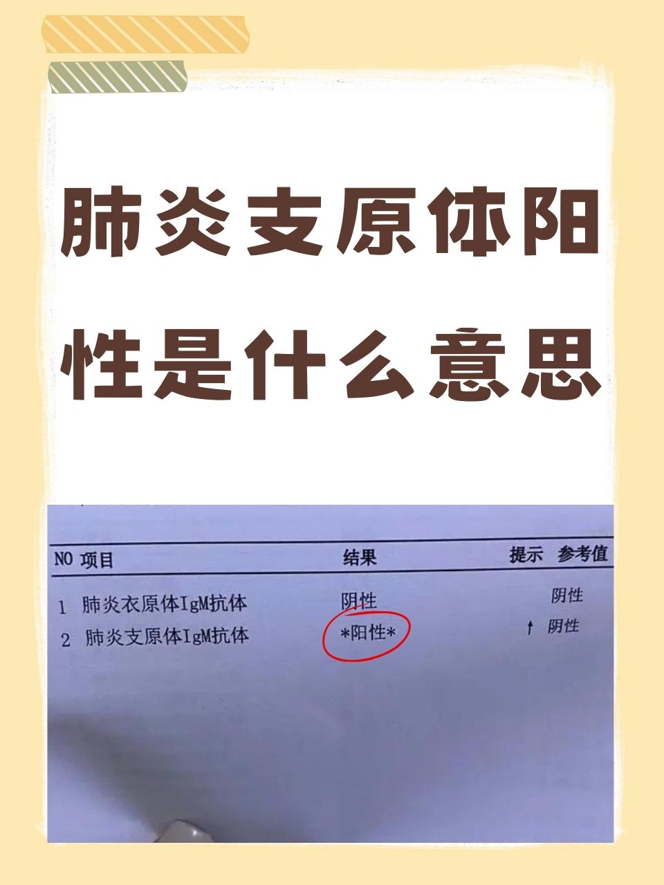 肺炎支原体阳性是什么意思  肺炎支原体阳性,这一检查结果往往让许多