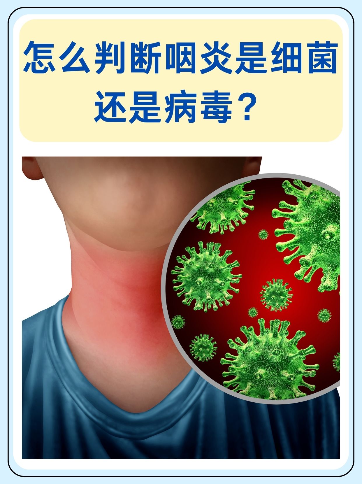 喉咙发炎症状图片