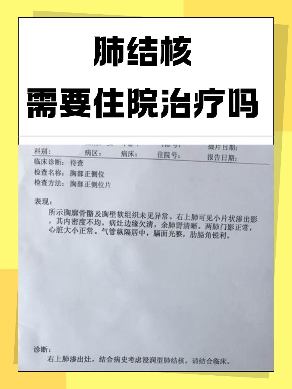 在呼吸系统疾病的谱系中,肺结核以其独特的传染性和复杂性备受关注.
