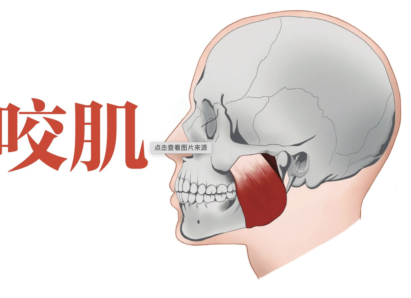 颞肌发达图片