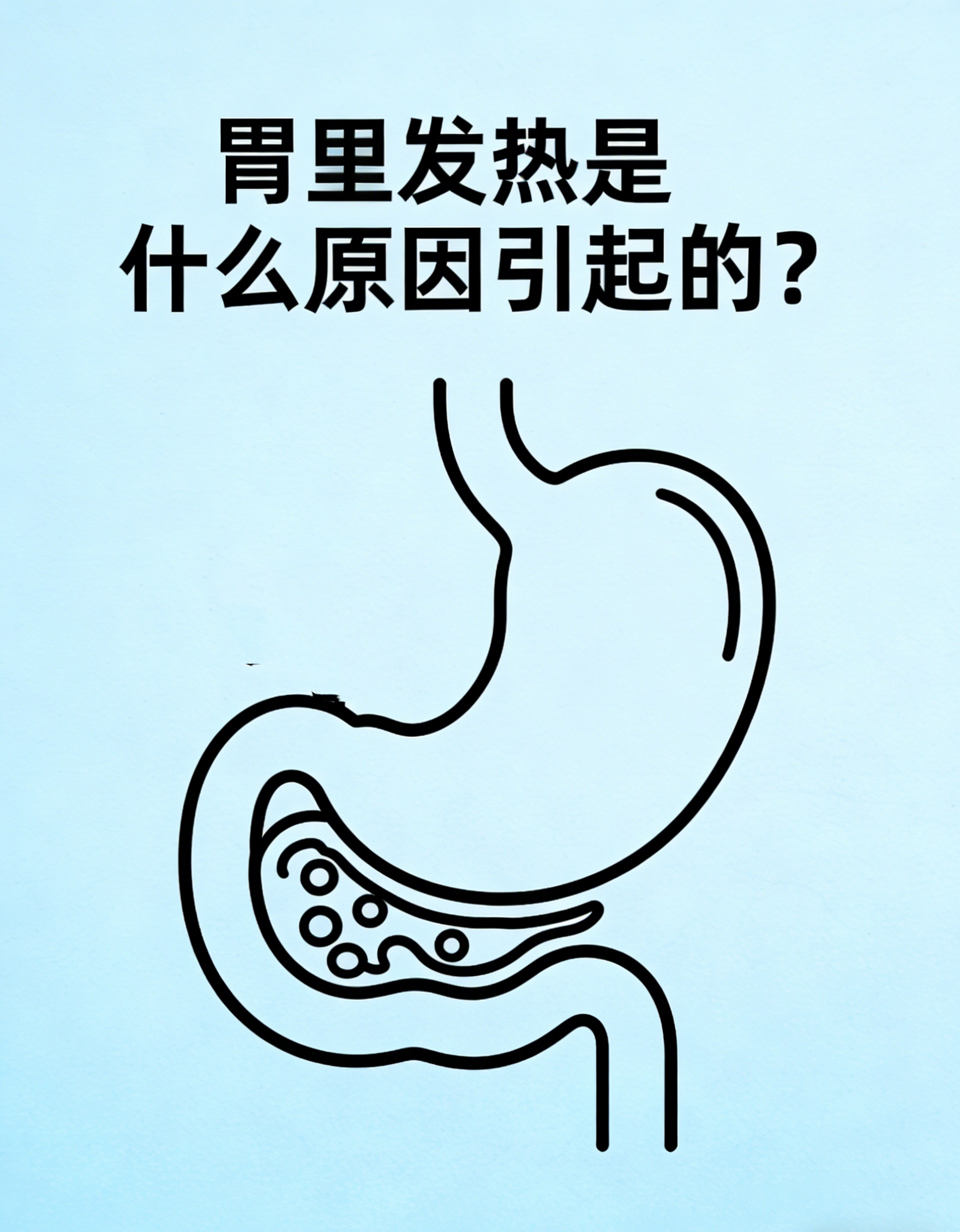 胃里发热多因胃酸反流或胃黏膜炎症刺激所致常见于胃炎胃食管反流