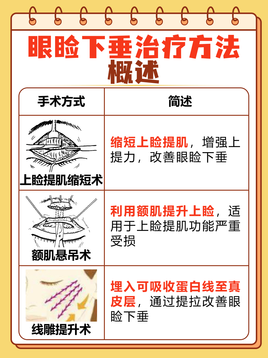 眼皮松弛下垂最好解决方法眼睑下垂的最好治疗办法提肌缩短手术示意图