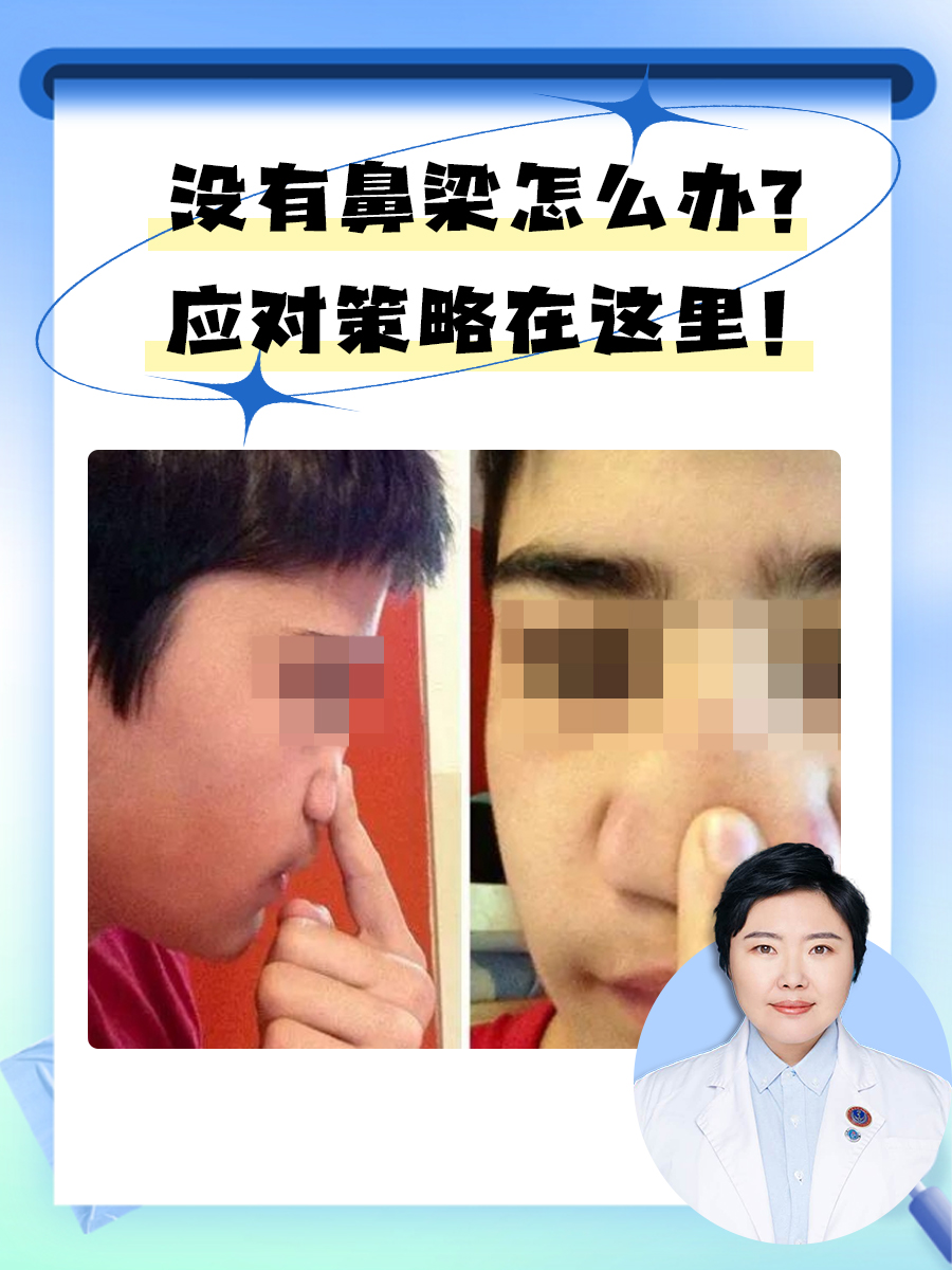 是从鼻根到鼻尖的硬骨或软骨结构,是构成鼻子轮廓的重要部分