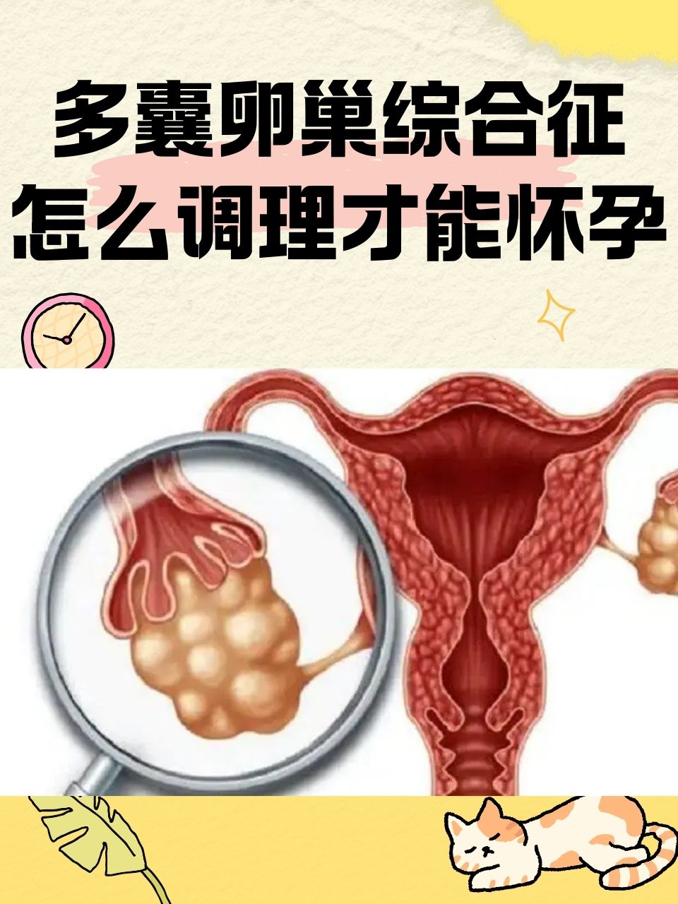 多囊性卵巢是怎样形成的(多囊卵巢是怎么形成的 特点是什么)  第2张