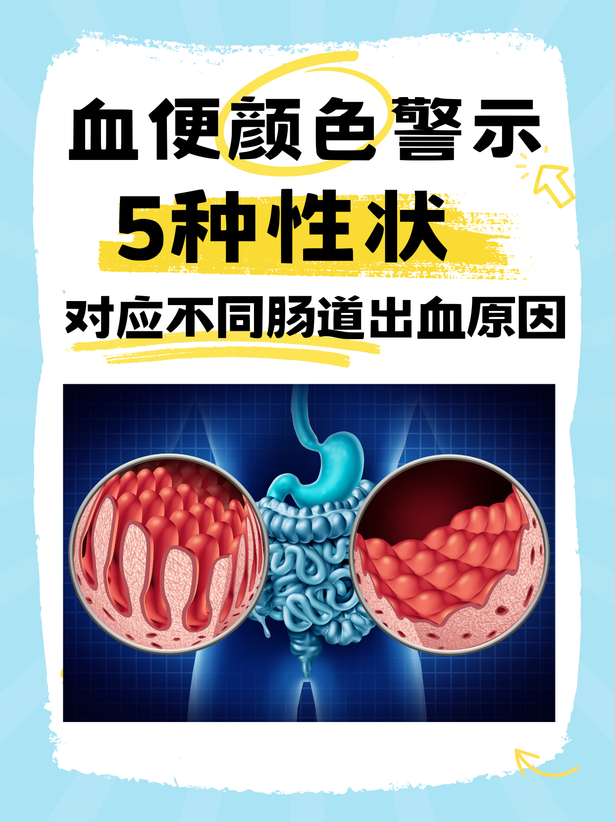 为什么便血鲜红色无痛为什么在线 为什么便血鲜红色无痛为什么在线