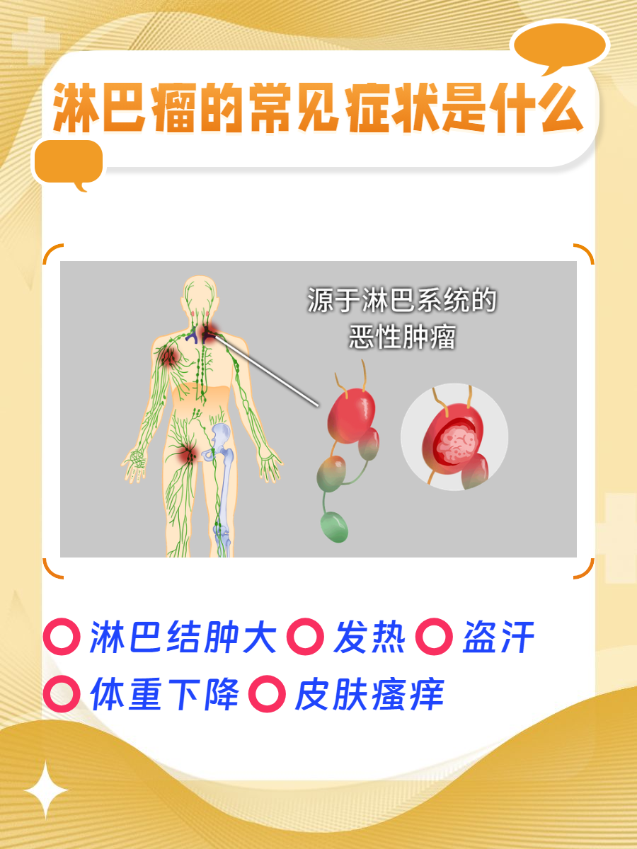 大腿腹股沟淋巴瘤图片图片