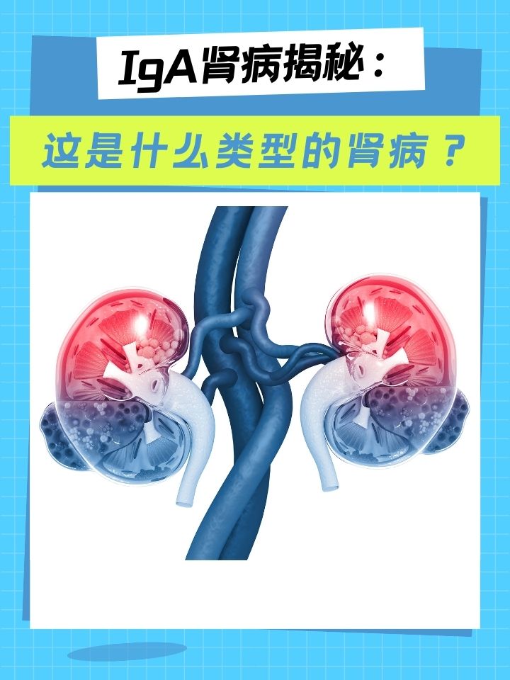 iga肾病揭秘:这是什么类型的肾病?