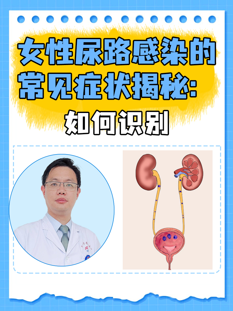 女性尿路感染的常见症状揭秘:如何识别  尿路感染,这个让许多女性困扰