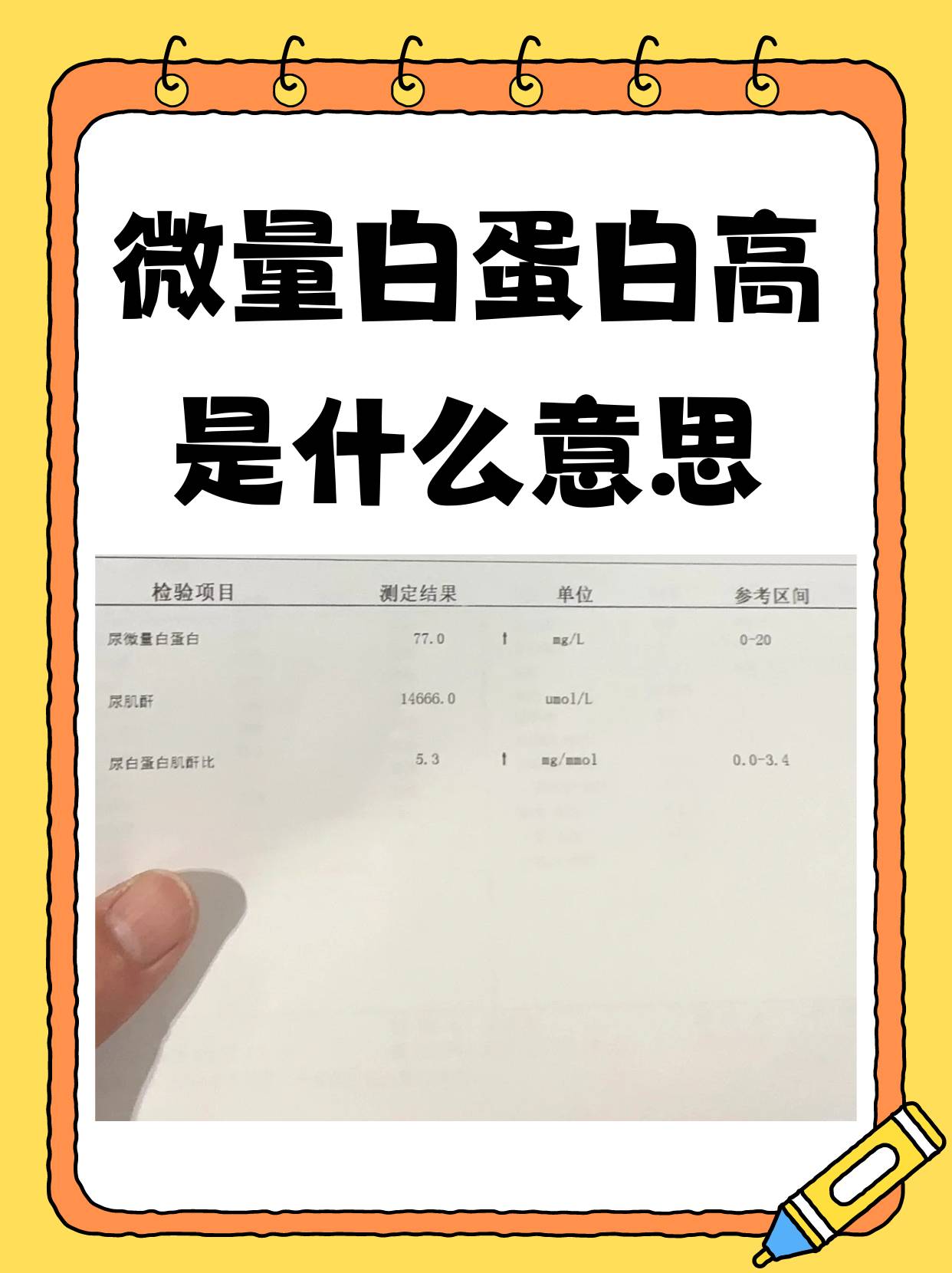 微量白蛋白是指在人体尿液或血液中出现的少量白蛋白