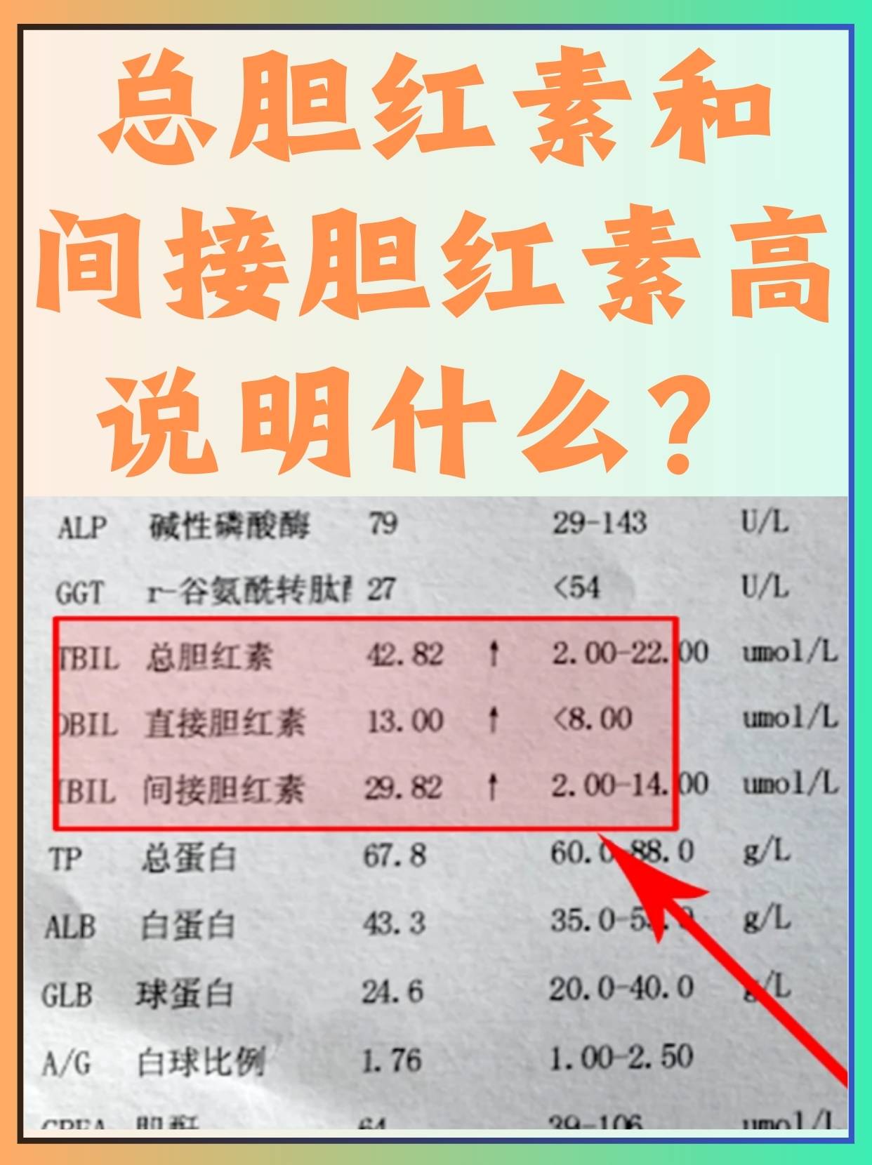 总胆红素和间接胆红素高说明什么