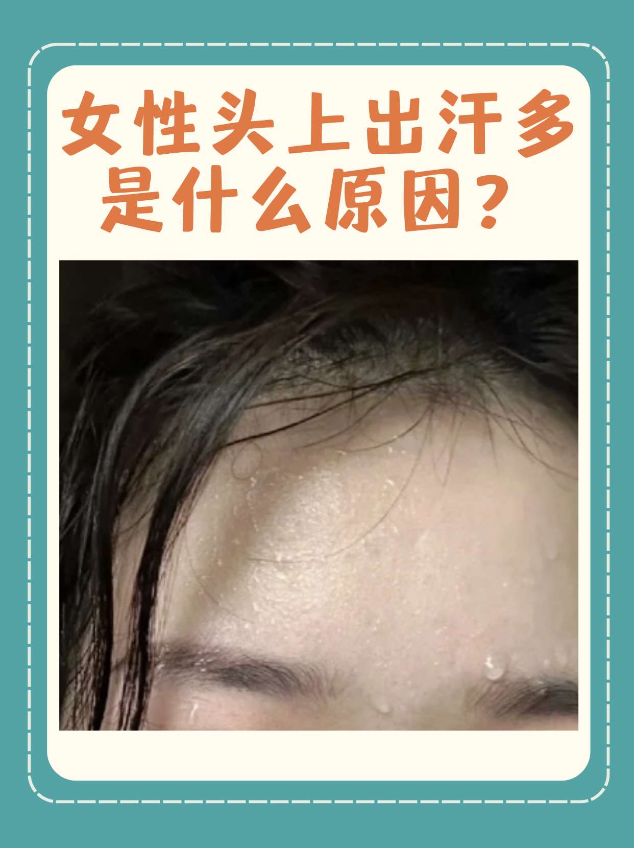 女性头上出汗多是什么原因?