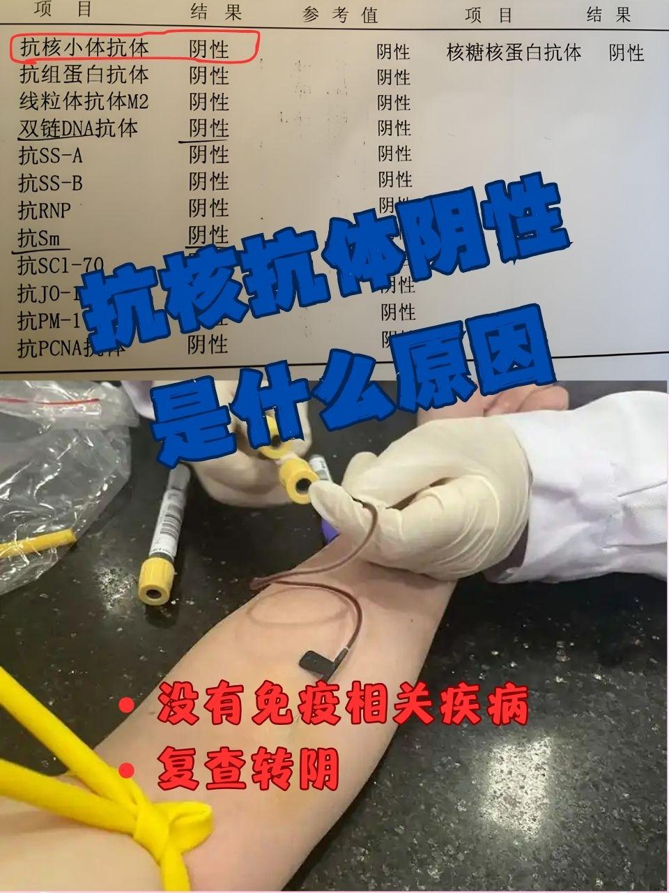 检测是风湿免疫科常用的一项筛查试验,当抗核