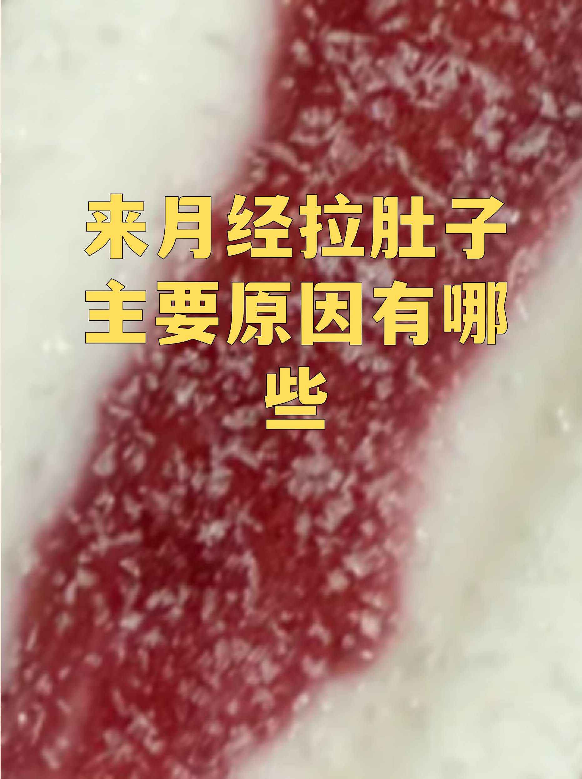 常见原因激素影响月经期前列腺素分泌增加刺激肠道 盆腔充