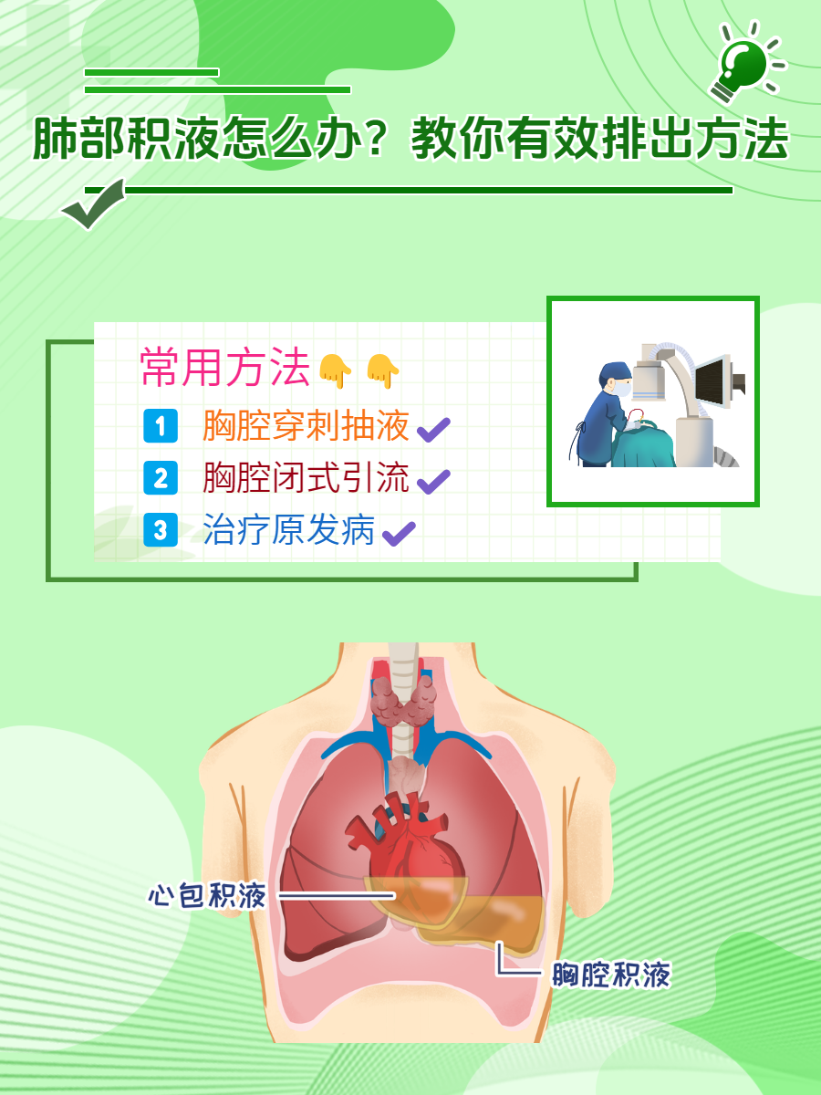 心包积液抽液原则图片