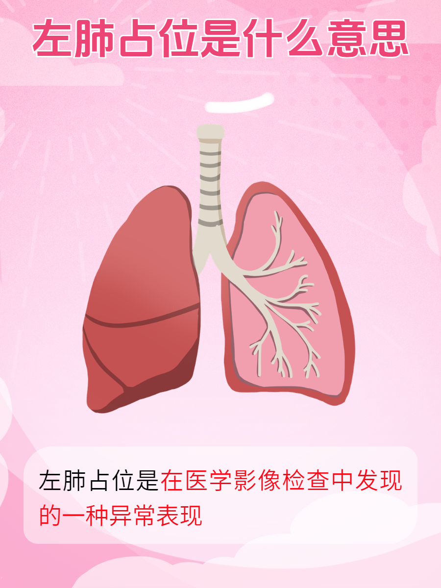 肺门图片位置图片