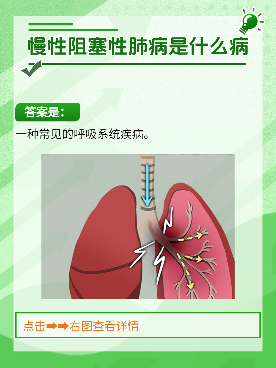 慢性阻塞性肺病是一种常见的呼吸系统疾病,主要