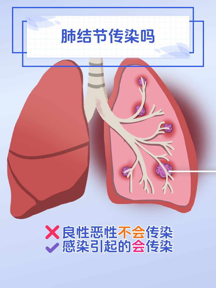  近期病毒感冒对肺结节有影响吗(病毒性感冒会影响肺吗)