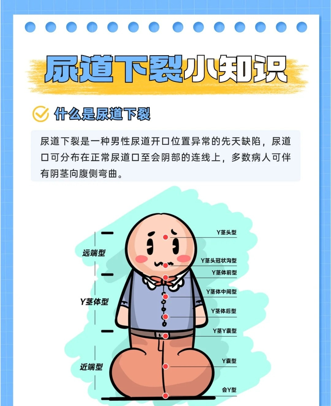 尿道下裂是指尿道开口位置异常的先天缺陷,尿道口可分布在正常尿道口